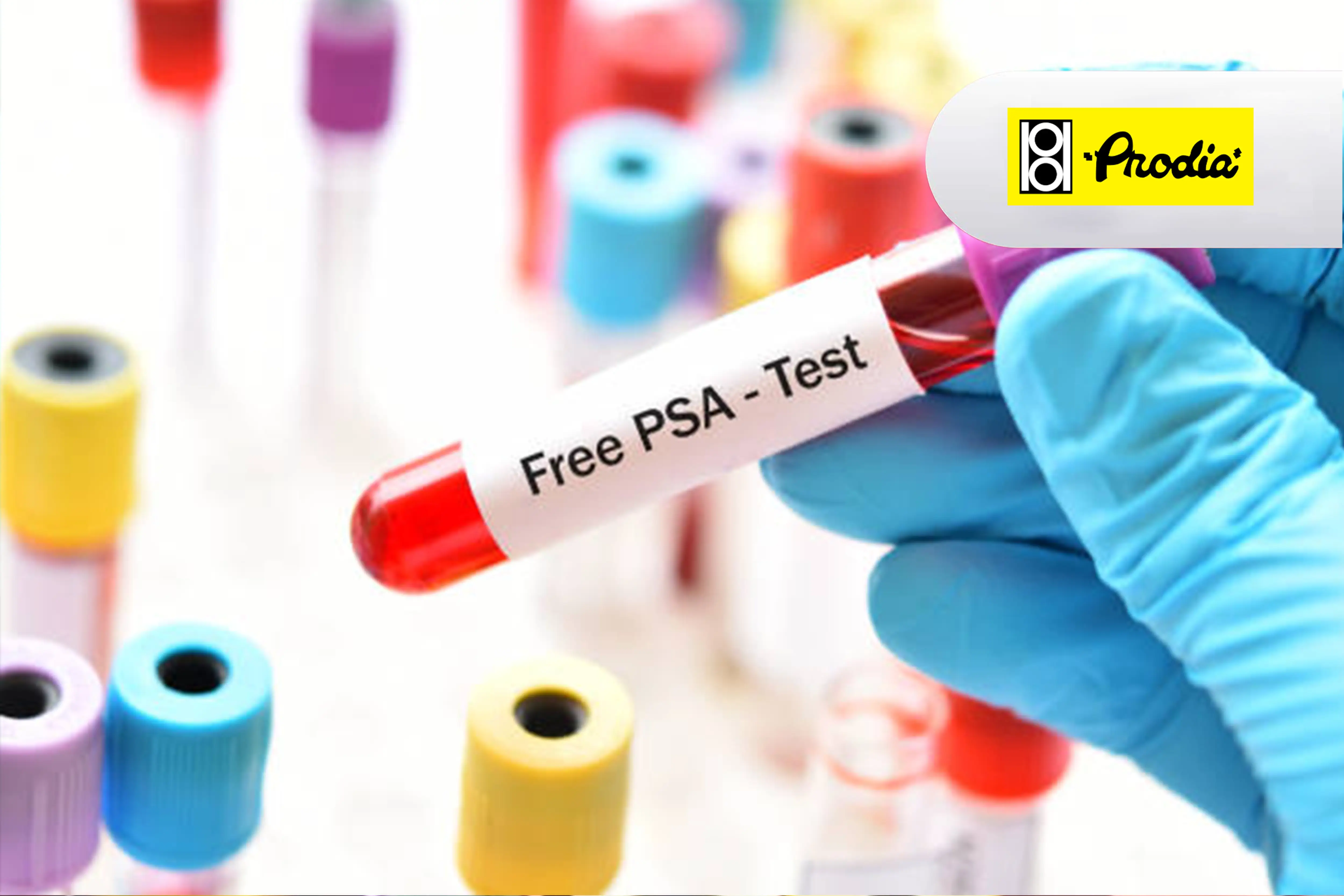 Prodia-FREE PSA TEST_1726201889.webp